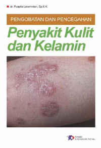 Image of PENGOBATAN DAN PENCEGAHAN Penyakit Kulit dan Kelamin